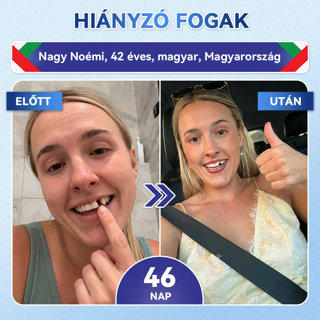 🦷𝐆𝐥𝐢𝐦𝐦𝐞𝐫𝐥𝐲® Tideglusib Fog & íny Javító mikrotűs tapasz | Fejlett őssejt-aktiváló fogcsíkok (újjáépíti a fogzománcot és a dentint • erősíti az ínyt • megszünteti a fogkövet és a szagokat • megállítja a fogérzékenységet)) 3.0