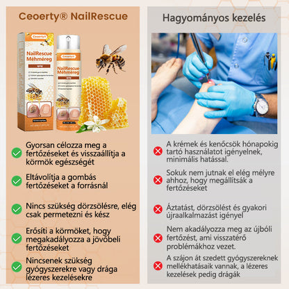 2026🎁 Korlátozott idejű akció 70% kedvezménnyel ️️⏳ Ceoerty® körömgomba spray méhméreggel 💥 2 hét alatt megoldja az összes körömproblémát