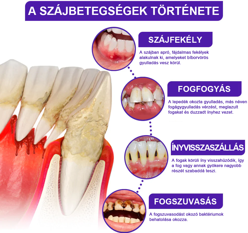 🌟 Rolimey® VioCore Propolisz fogkrém 🦷 Fogfájás enyhítése 3 nap alatt · 7 napos ínyregeneráció · Parodontális betegségek megelőzése · Méhméreg és természetes ásványi anyagok tökéletes kombinációja 🌟
