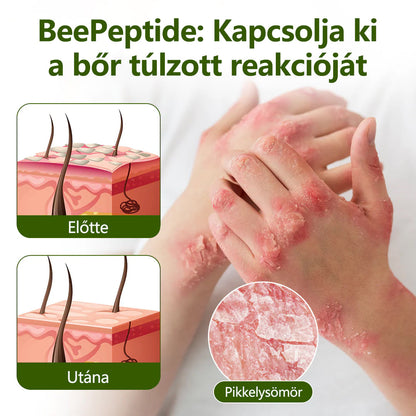 Tivora®✨ MéhPeptid GyökérPuhító Kétirányú Megkönnyebbülés Krém