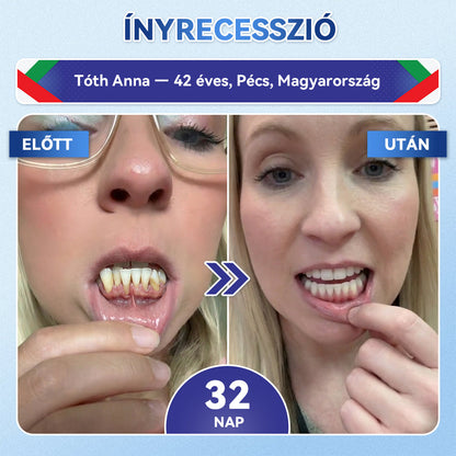 🦷𝐆𝐥𝐢𝐦𝐦𝐞𝐫𝐥𝐲® Tideglusib Fog & íny Javító mikrotűs tapasz | Fejlett őssejt-aktiváló fogcsíkok (újjáépíti a fogzománcot és a dentint • erősíti az ínyt • megszünteti a fogkövet és a szagokat • megállítja a fogérzékenységet)) 3.0