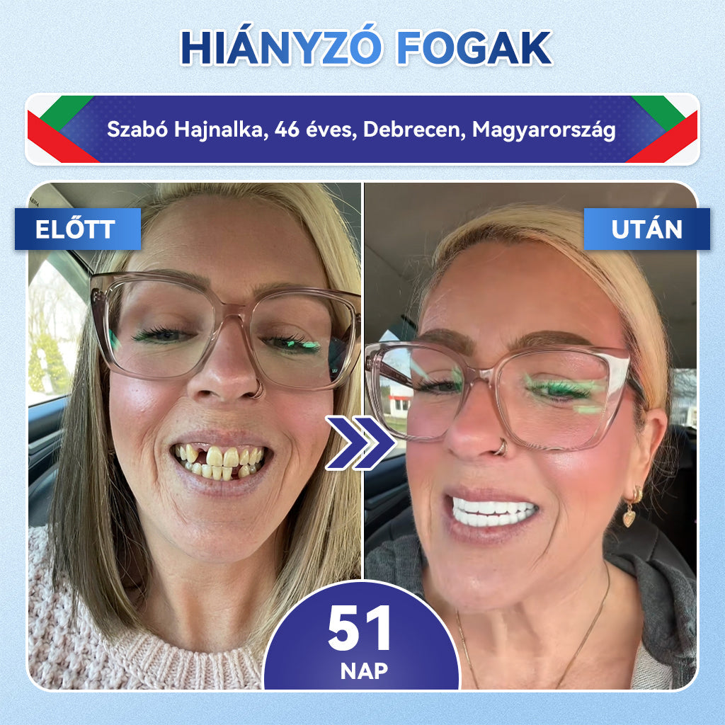 🦷𝐆𝐥𝐢𝐦𝐦𝐞𝐫𝐥𝐲® Tideglusib Fog & íny Javító mikrotűs tapasz | Fejlett őssejt-aktiváló fogcsíkok (újjáépíti a fogzománcot és a dentint • erősíti az ínyt • megszünteti a fogkövet és a szagokat • megállítja a fogérzékenységet)) 3.0
