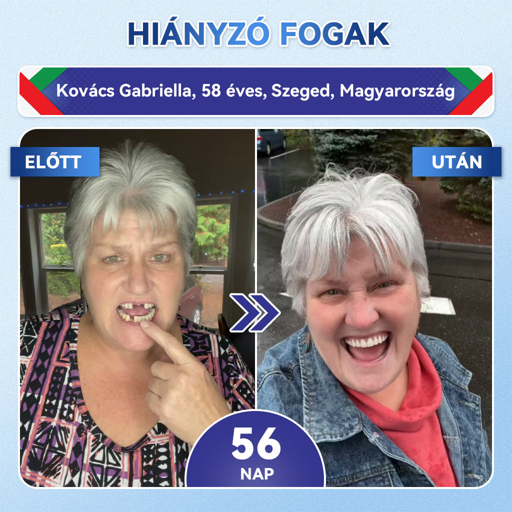 🦷𝐆𝐥𝐢𝐦𝐦𝐞𝐫𝐥𝐲® Tideglusib Fog & íny Javító mikrotűs tapasz | Fejlett őssejt-aktiváló fogcsíkok (újjáépíti a fogzománcot és a dentint • erősíti az ínyt • megszünteti a fogkövet és a szagokat • megállítja a fogérzékenységet)) 3.0