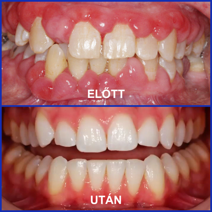 🌟 Rolimey® VioCore Propolisz fogkrém 🦷 Fogfájás enyhítése 3 nap alatt · 7 napos ínyregeneráció · Parodontális betegségek megelőzése · Méhméreg és természetes ásványi anyagok tökéletes kombinációja 🌟