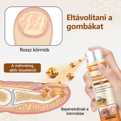 2026🎁 Korlátozott idejű akció 70% kedvezménnyel ️️⏳ Ceoerty® körömgomba spray méhméreggel 💥 2 hét alatt megoldja az összes körömproblémát
