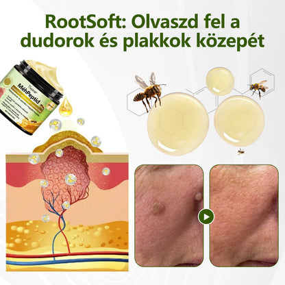 Tivora®✨ MéhPeptid GyökérPuhító Kétirányú Megkönnyebbülés Krém