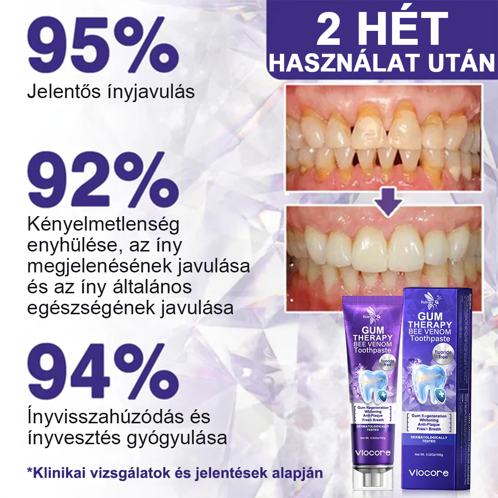 🌟Rolimey® VioCore Méhméreg Fogkezelő Fogkrém-🌿