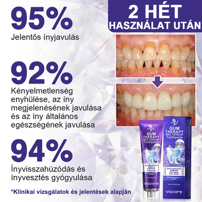 🌟 Rolimey® VioCore Propolisz fogkrém 🦷 Fogfájás enyhítése 3 nap alatt · 7 napos ínyregeneráció · Parodontális betegségek megelőzése · Méhméreg és természetes ásványi anyagok tökéletes kombinációja 🌟