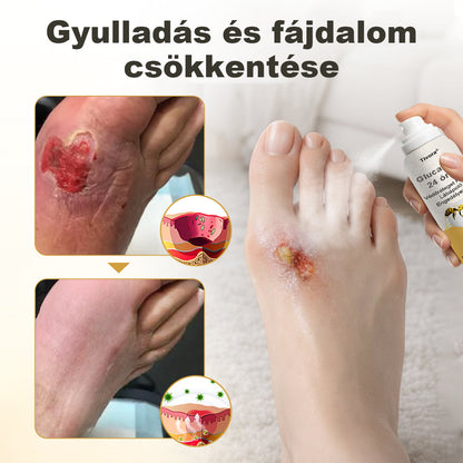 Tivora® GlucaVeil 24 órás Védőréteget Képző Lábápoló Permet