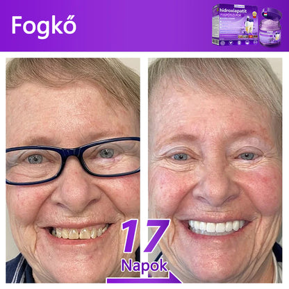 𝐷𝑜𝒓𝒎𝒐𝒓𝑛𝑎® Fogregeneráló és -javító por hidroxiapatittal 🦷 (hatékonyan javítja a fogszuvasodást, az ínyproblémákat, a fogak túlérzékenységét, a szájfekélyeket és a fogak sárgulását, átfogóan javítva a szájhigiéniát) 🍀