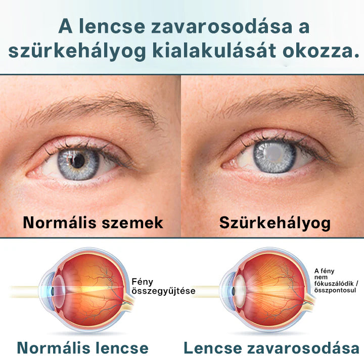 🔥Laleia® Opti Fusion Nano szemcsepp szérum🪞