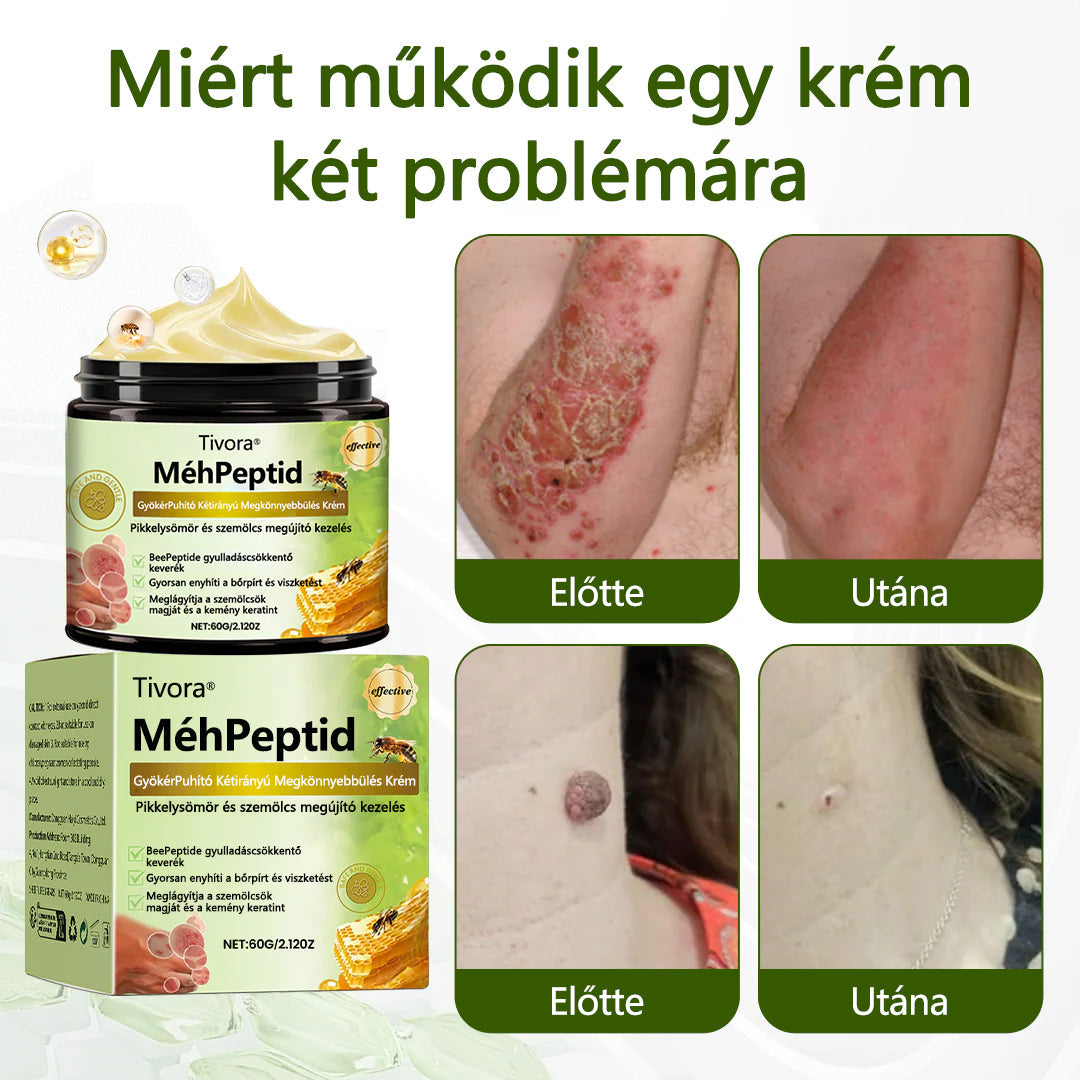 Tivora®✨ MéhPeptid GyökérPuhító Kétirányú Megkönnyebbülés Krém