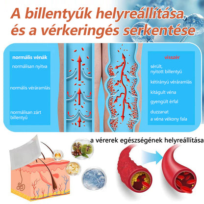 ☘️ Zvoevo® Vein Ease mikro-tűs ápoló tapasz (pókgerincvénák, visszér, duzzanat, fáradt lábak kezelésére)
